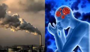 Air Pollution and Brain Health