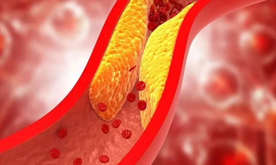 Cholesterol Control Tips