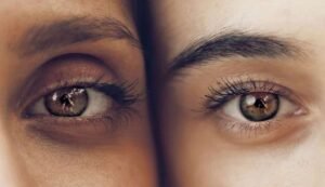 Dark Circles Removal Exercise