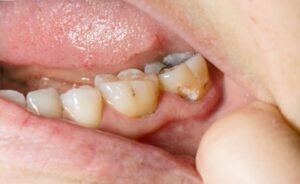 Dental Care Best Practices