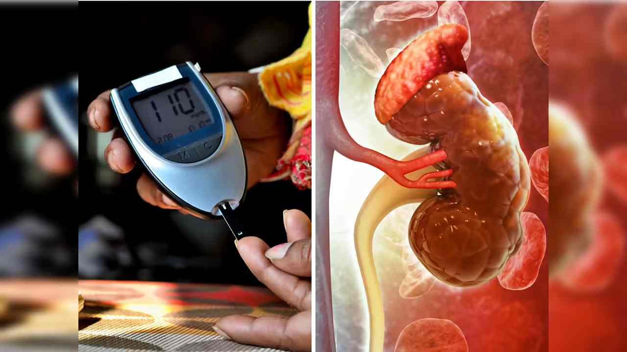 Diabetes Kidney Health