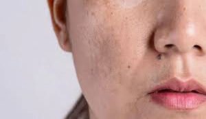 Boroline Beauty Benefits and Hacks