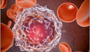 Early Cancer Detection