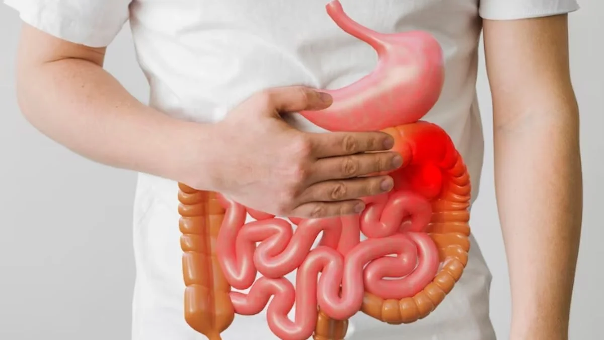 Foods Causing Bloating and Acidity