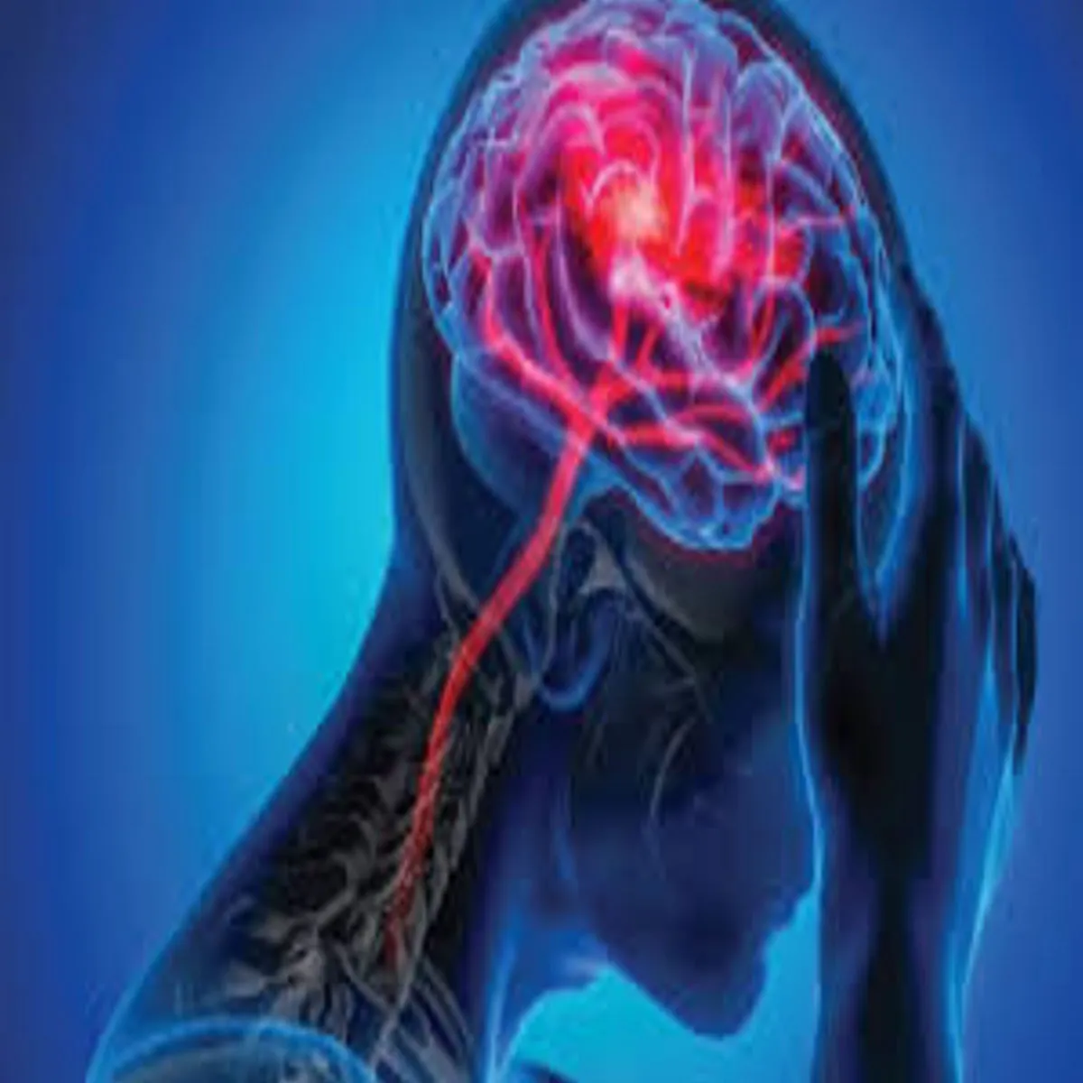 Alzheimerrisk Alzheimerrisk Prdush Bdhta Yaddasht Kmjor