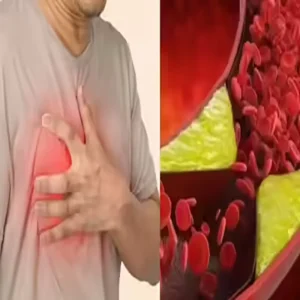 cholesterol walk key for heart health