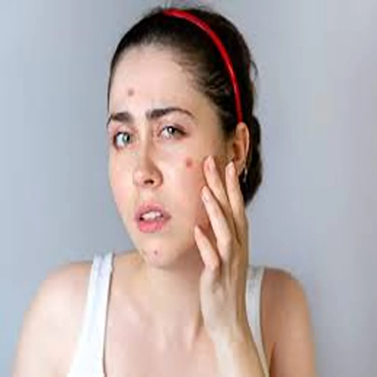 Cortisol Face Cortisol Face Tnav Kaise