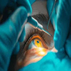 gorakhpur cataract surgery infection case 1