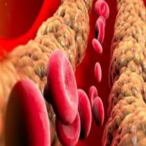 high triglyceride heart liver risk