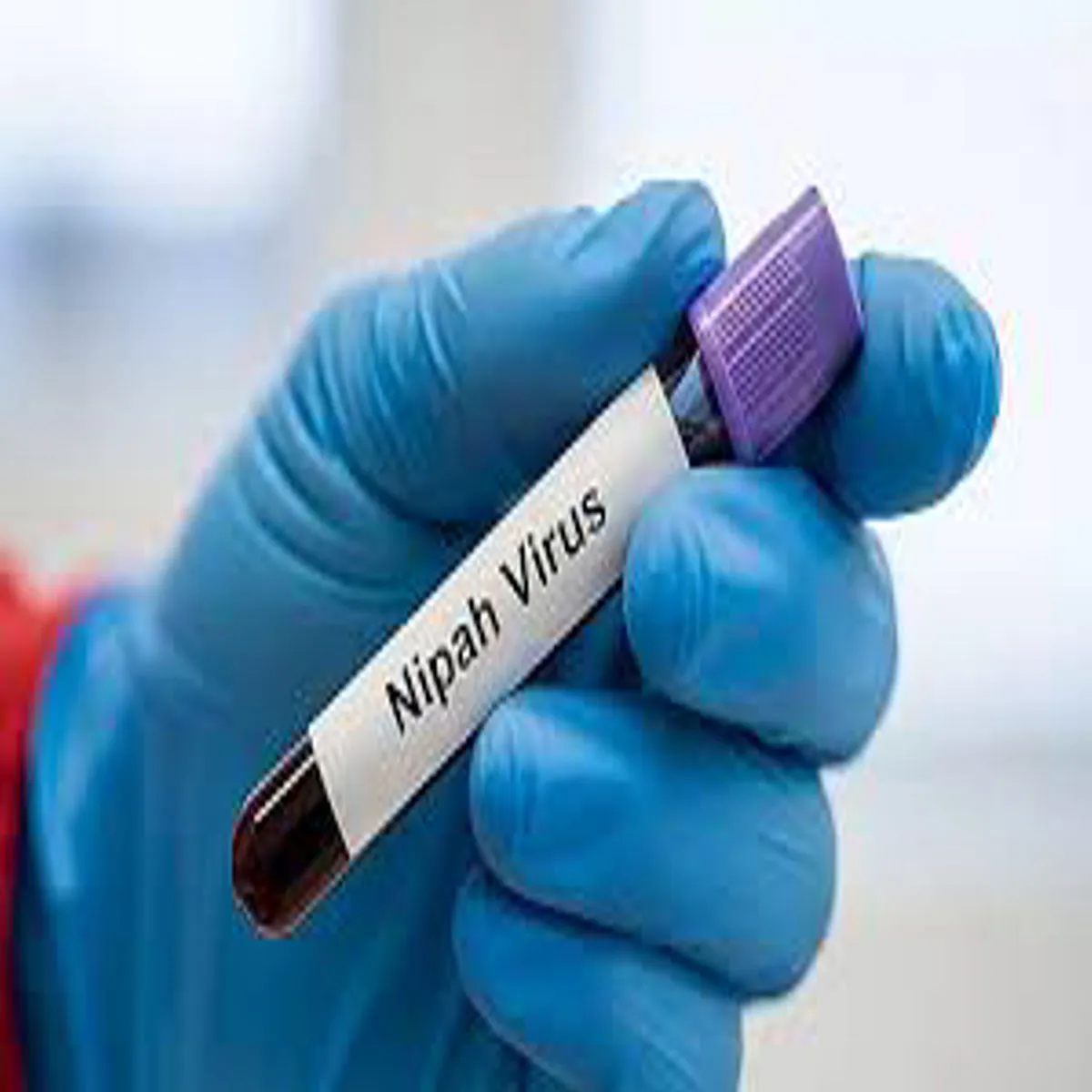 Nipahvirus Nipahvirus Pshchim Bngal Men Snkrmit