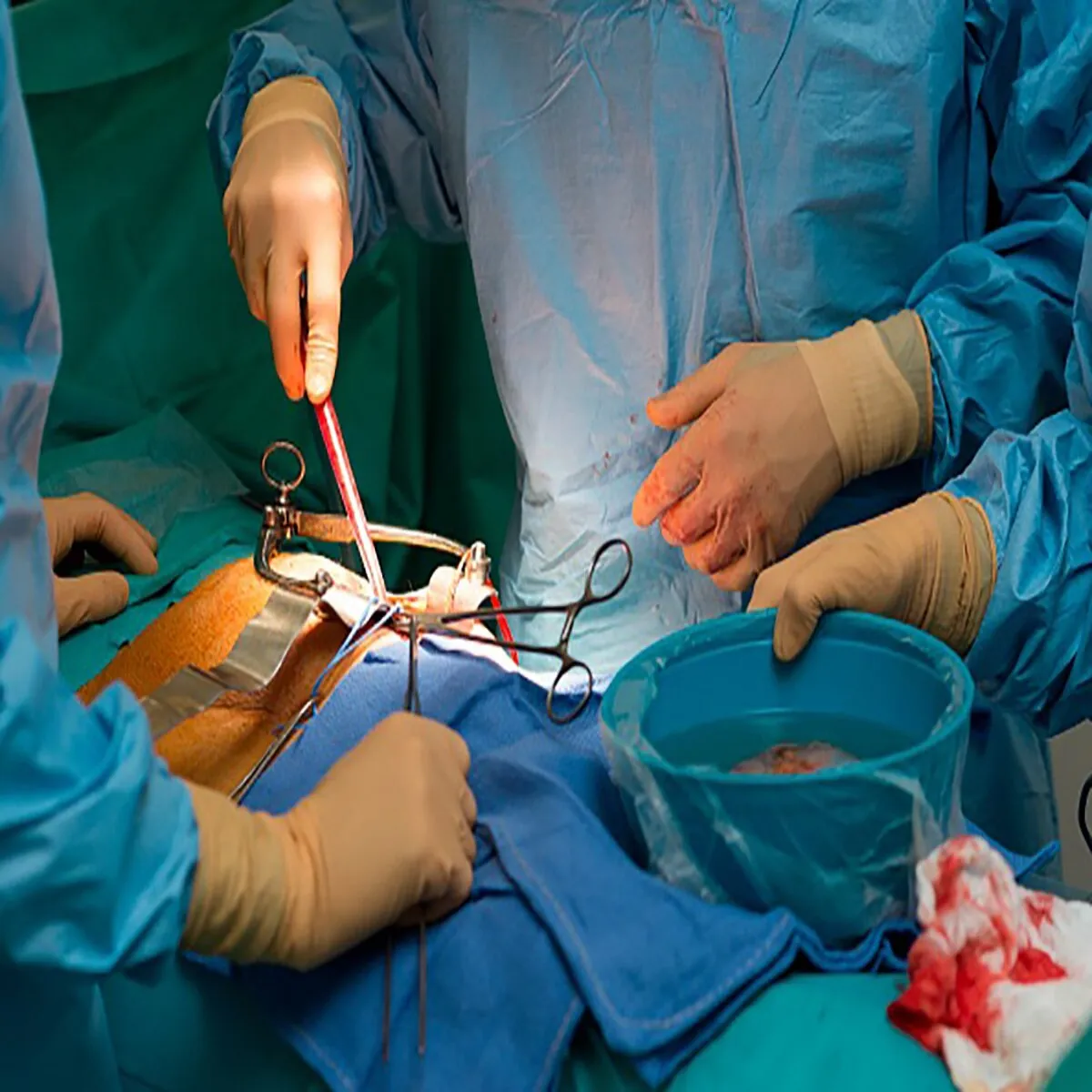 Healthscam Healthscam Kanpur Men Kidni Livr