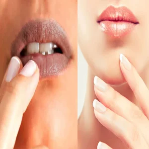natural lip care home remedy for dark lips