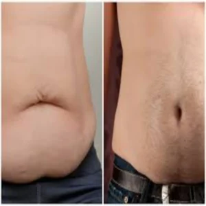 hard belly fat health risk explained