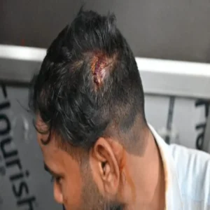 lucknow power theft team attack case