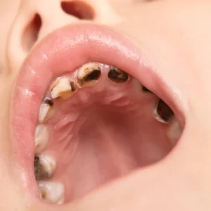 oral care tips for babies teeth health