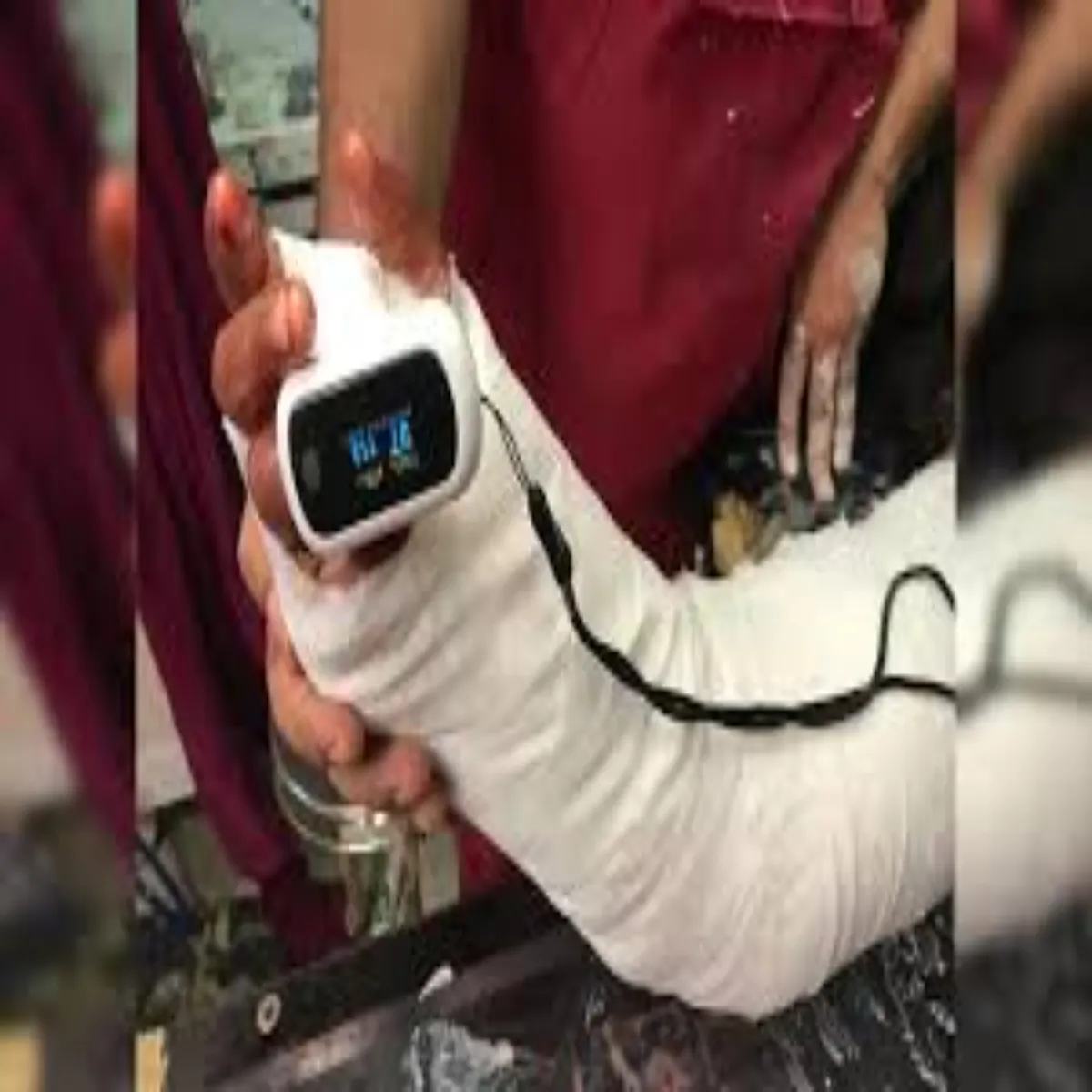 Medicalprobe Medicalprobe Kte Hath Janch Lekr