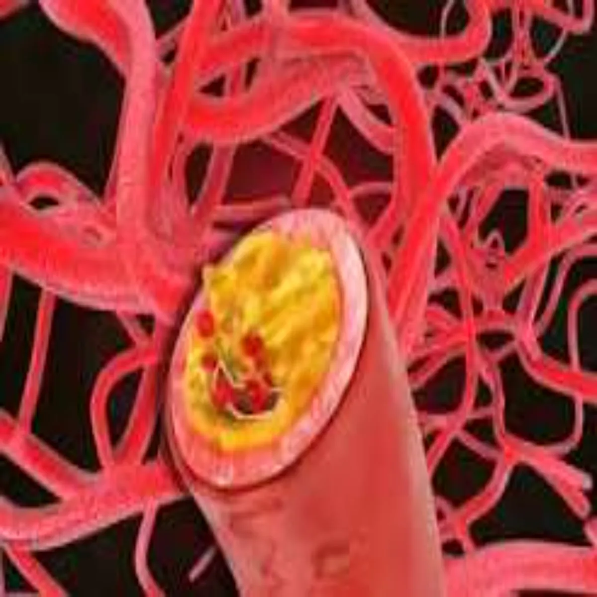 Cholesterol Good Bad Cholesterol Cholesterol Hart