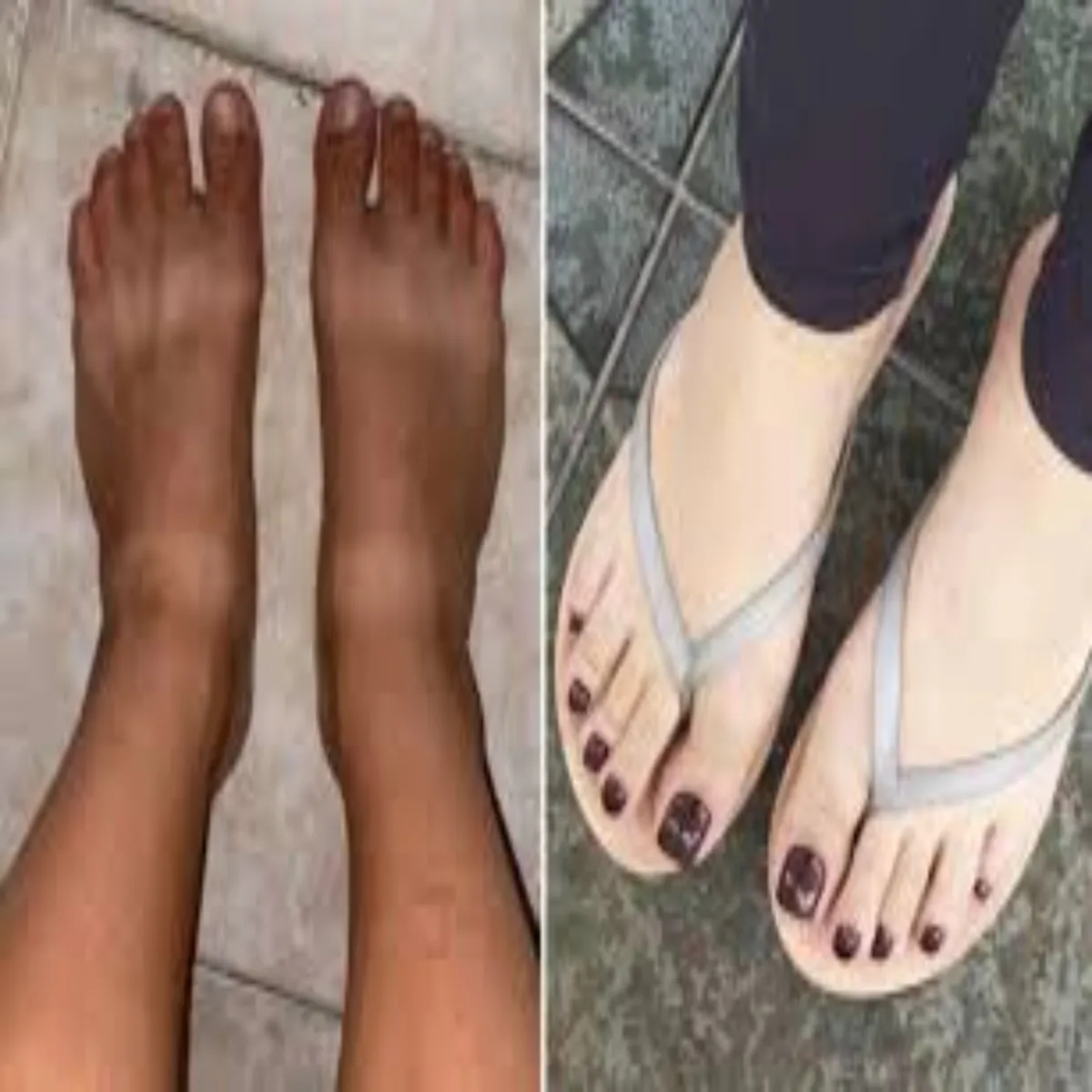 Footcare Footcare Ghr Aasan Phut Sok
