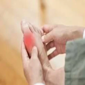 uric acid morning habits