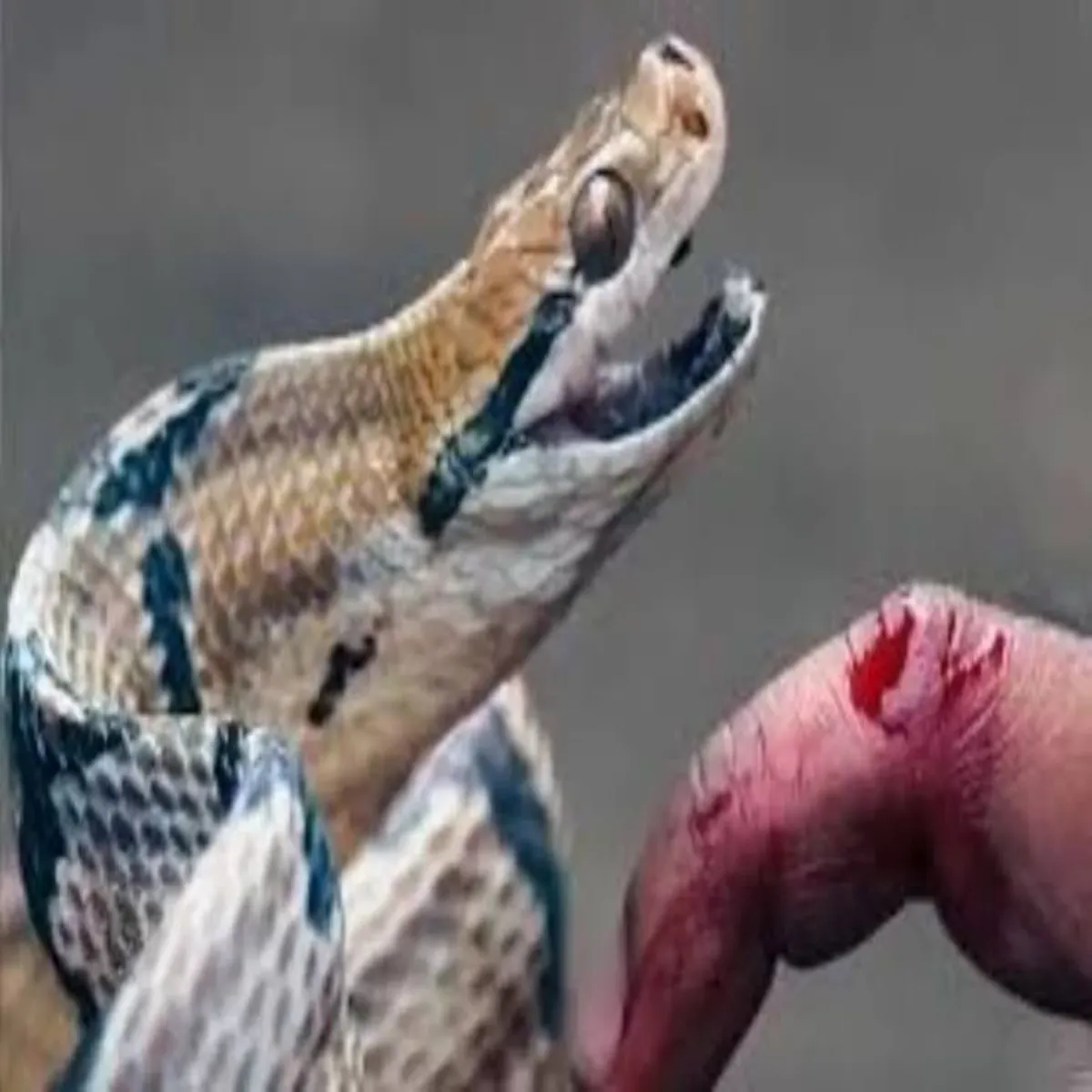 Snakebite Snakebite Pnjab Men Mjduri Rhe